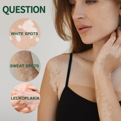 HEALSY™Pigment Repair Treatment Cream