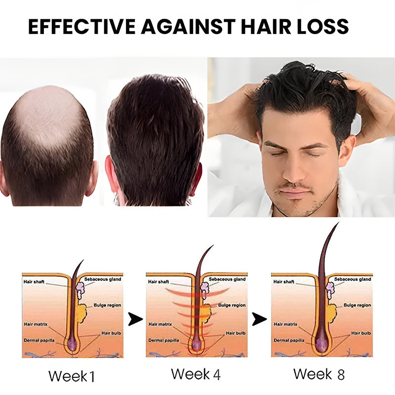 Lemcoy™ Hair Growth Spray