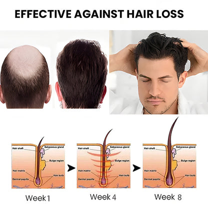 Lemcoy™ Hair Growth Spray