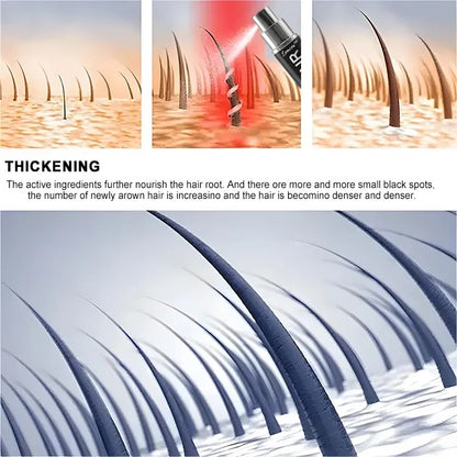 Lemcoy™ Hair Growth Spray