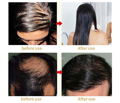 Laser Scalp Massage Combs