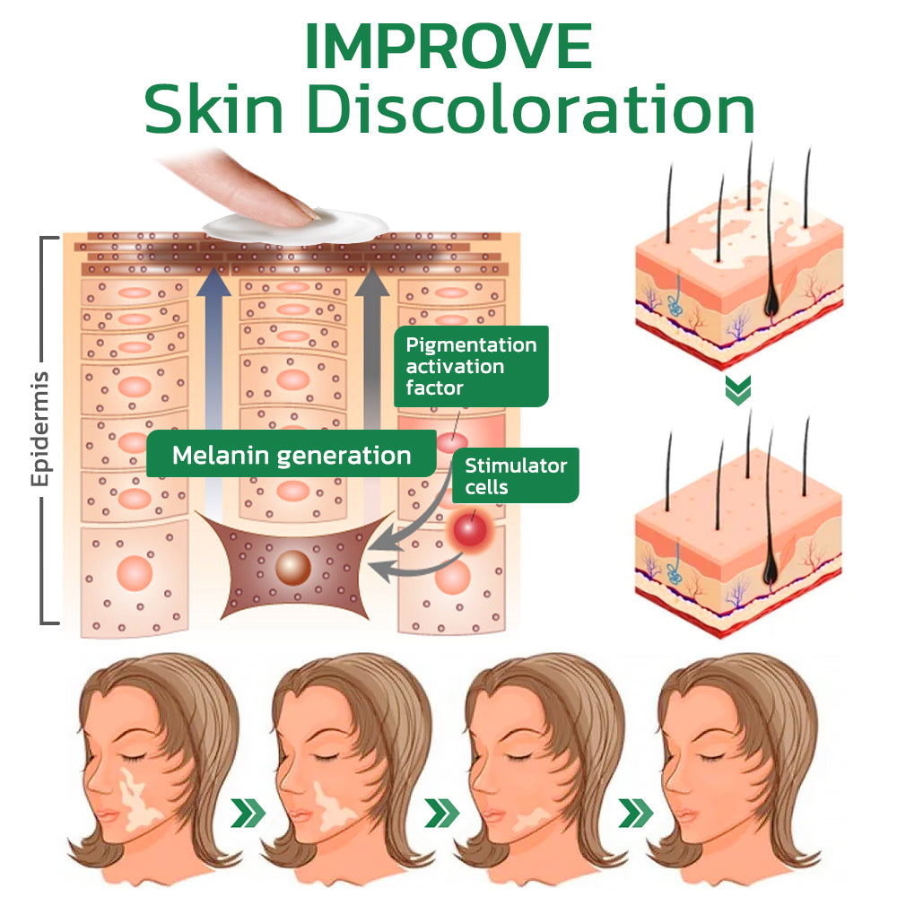 HEALSY™Pigment Repair Treatment Cream