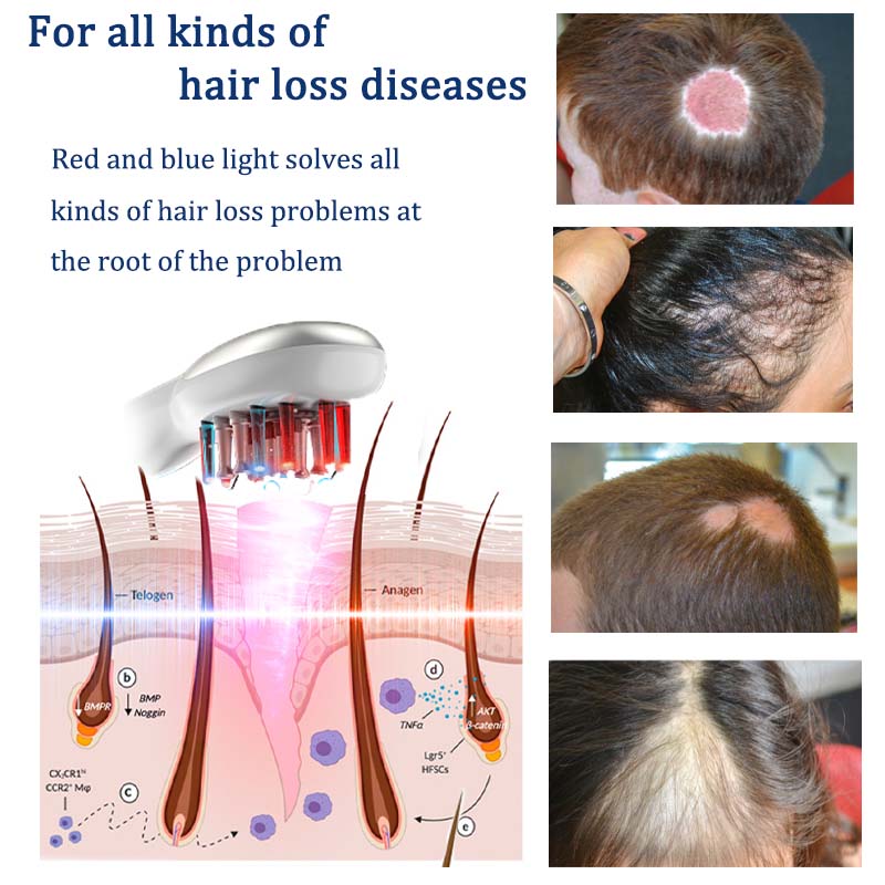 Laser Scalp Massage Combs